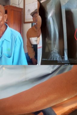 berita-rekomendasi-foto