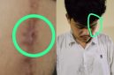 Foto kolase: MS, Korban dugaan pengeroyokan nampak luka dan lebam.