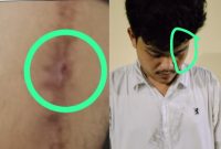Foto kolase: MS, Korban dugaan pengeroyokan nampak luka dan lebam.