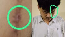 Foto kolase: MS, Korban dugaan pengeroyokan nampak luka dan lebam.