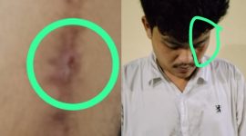 Foto kolase: MS, Korban dugaan pengeroyokan nampak luka dan lebam.
