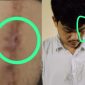 Foto kolase: MS, Korban dugaan pengeroyokan nampak luka dan lebam.